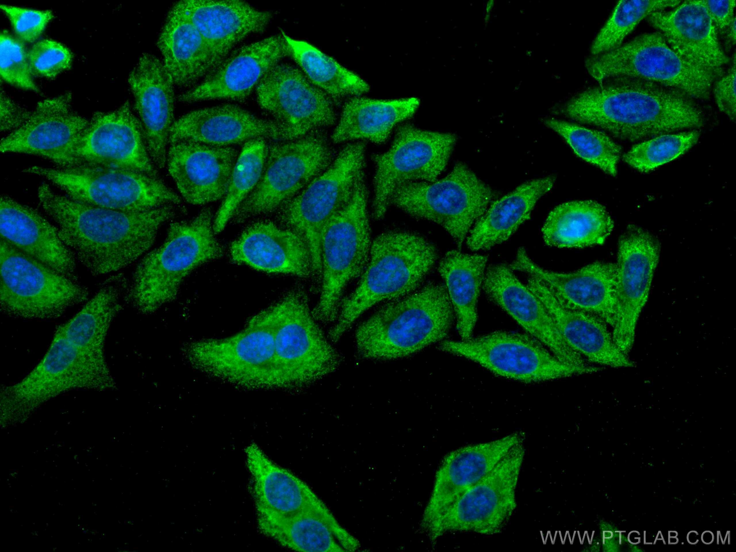 Immunofluorescence (IF) / fluorescent staining of HepG2 cells using CoraLite® Plus 488-conjugated FGFR3 Monoclonal ant (CL488-66954)