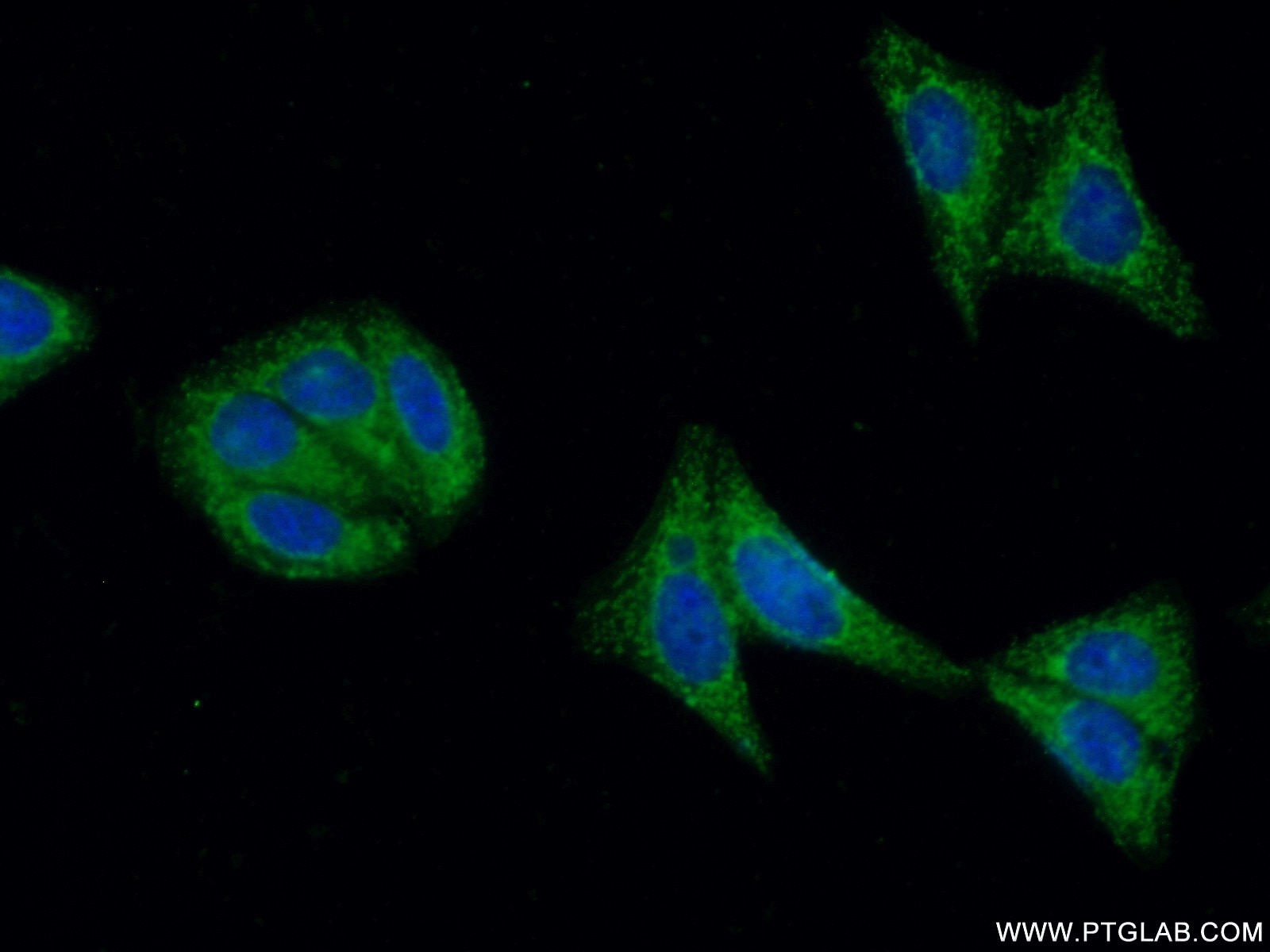 Immunofluorescence (IF) / fluorescent staining of HepG2 cells using FGFR4 Polyclonal antibody (11098-1-AP)
