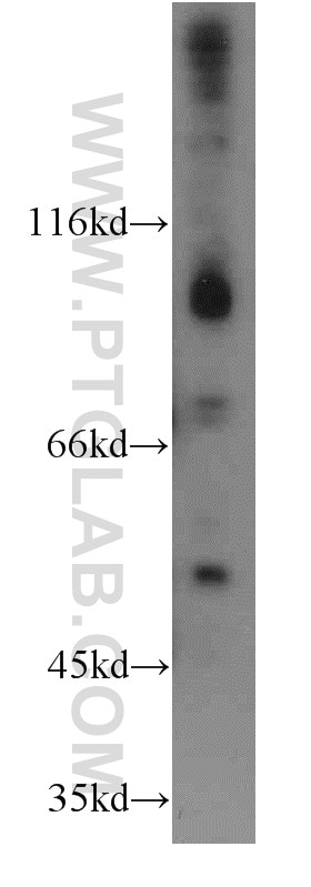 Western Blot (WB) analysis of mouse lung tissue using FGFR4 Polyclonal antibody (11098-1-AP)