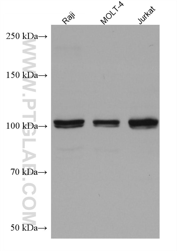 Western Blot (WB) analysis of various lysates using FGFR4 Monoclonal antibody (67800-1-Ig)