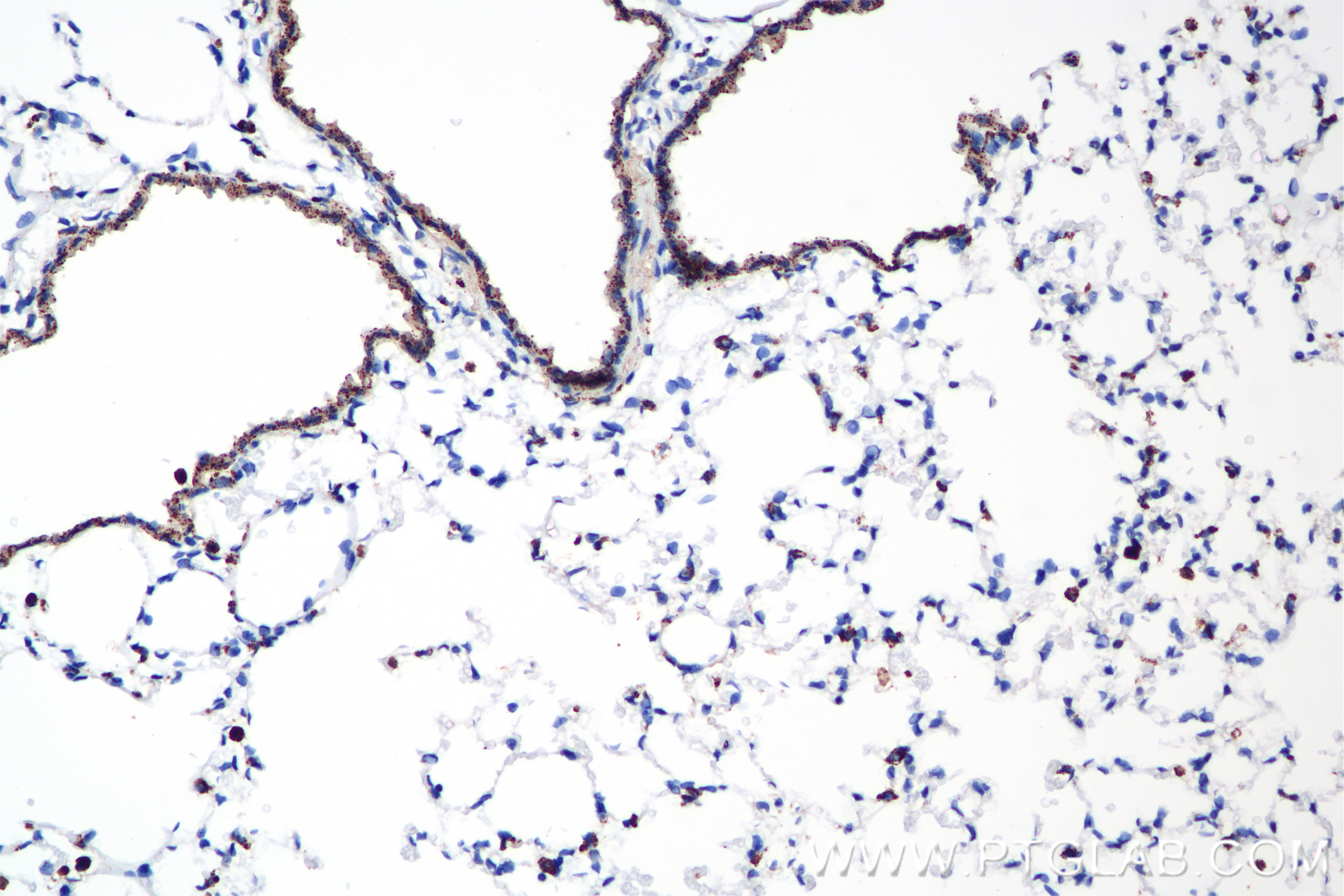 Immunohistochemistry (IHC) staining of mouse lung tissue using FGFR4 Recombinant antibody (81069-1-RR)