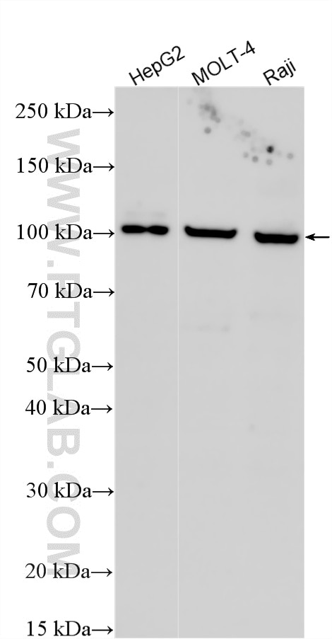 Western Blot (WB) analysis of various lysates using FGFR4 Recombinant monoclonal antibody (81069-1-RR)