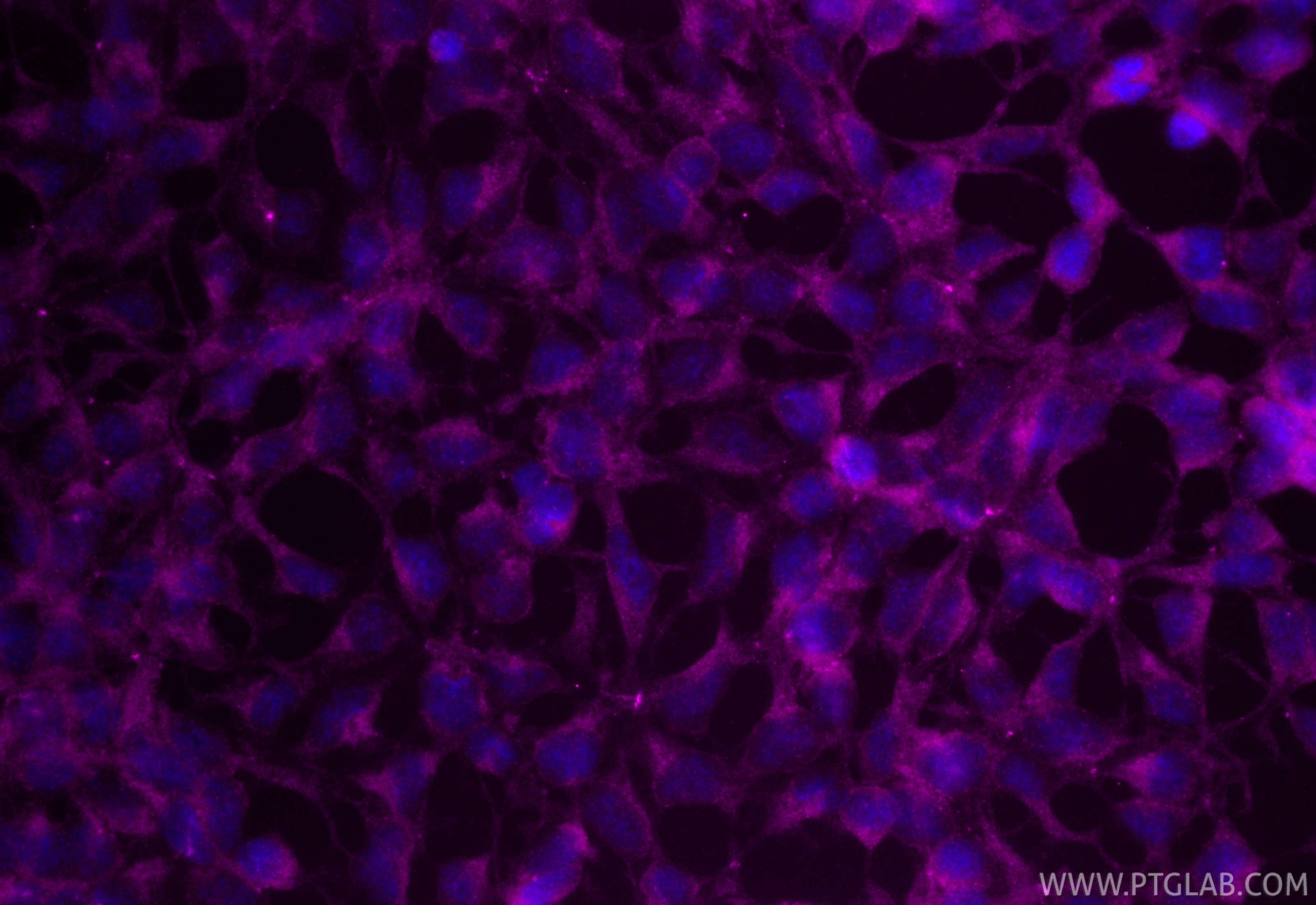 Immunofluorescent analysis of (-20°C Ethanol) fixed HEK-293 cells using CoraLite® Plus 647 FGFR4 antibody (CL647-11098) at dilution of 1:200. Immunofluorescence (IF) / fluorescent staining of HEK-293 cells using CoraLite® Plus 647-conjugated FGFR4 Polyclonal ant (CL647-11098)