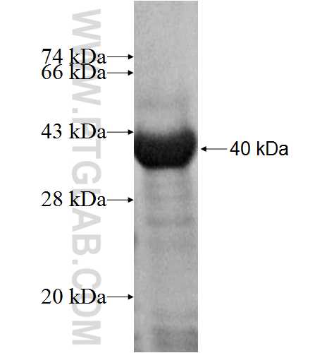FGFRL1 fusion protein Ag4704 SDS-PAGE
