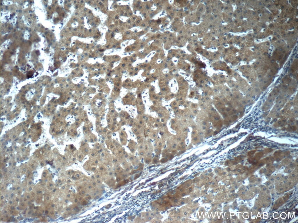 Fibrinogen Gamma Chain