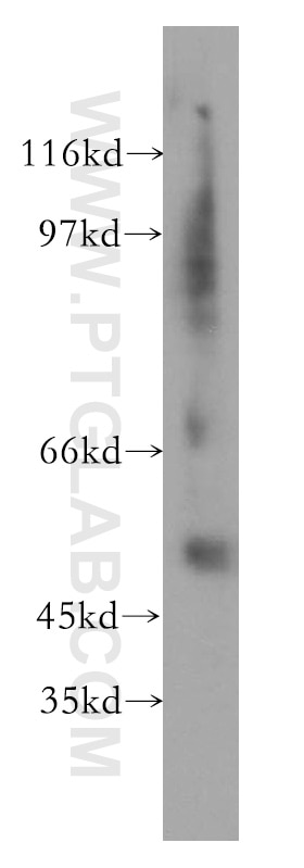 Western Blot (WB) analysis of human liver tissue using Fibrinogen Gamma Chain Polyclonal antibody (15841-1-AP)