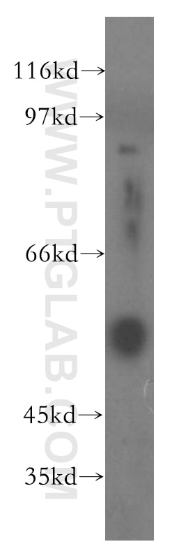 Western Blot (WB) analysis of human spleen tissue using Fibrinogen Gamma Chain Polyclonal antibody (15841-1-AP)