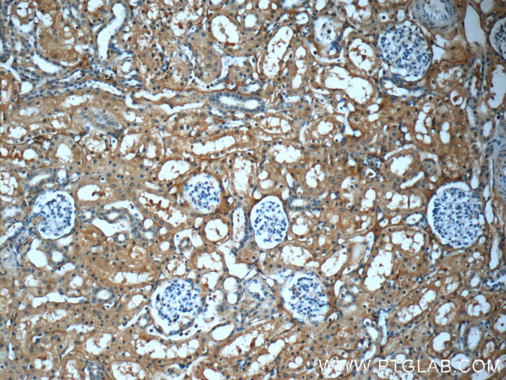 IHC staining of human kidney using 66158-1-Ig