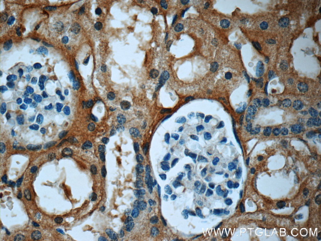 Immunohistochemistry (IHC) staining of human kidney tissue using Fibrinogen Gamma Chain Monoclonal antibody (66158-1-Ig)