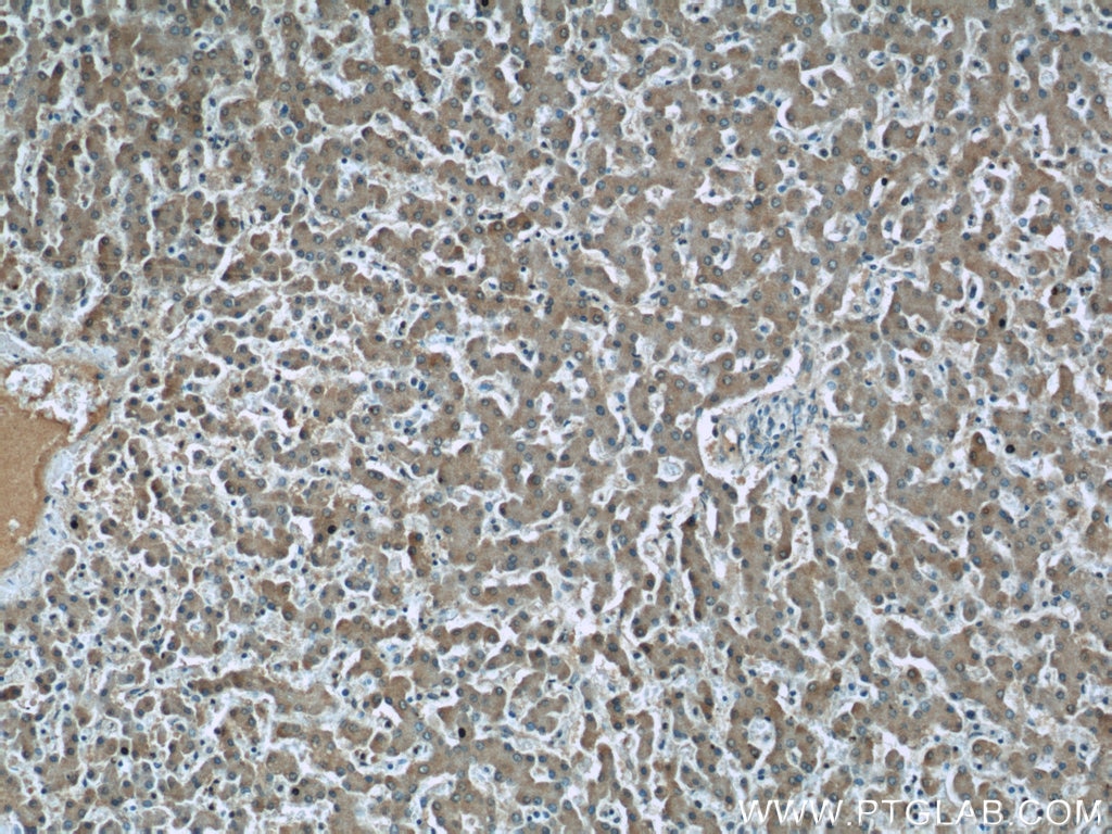 Immunohistochemistry (IHC) staining of human liver tissue using Fibrinogen Gamma Chain Monoclonal antibody (66158-1-Ig)