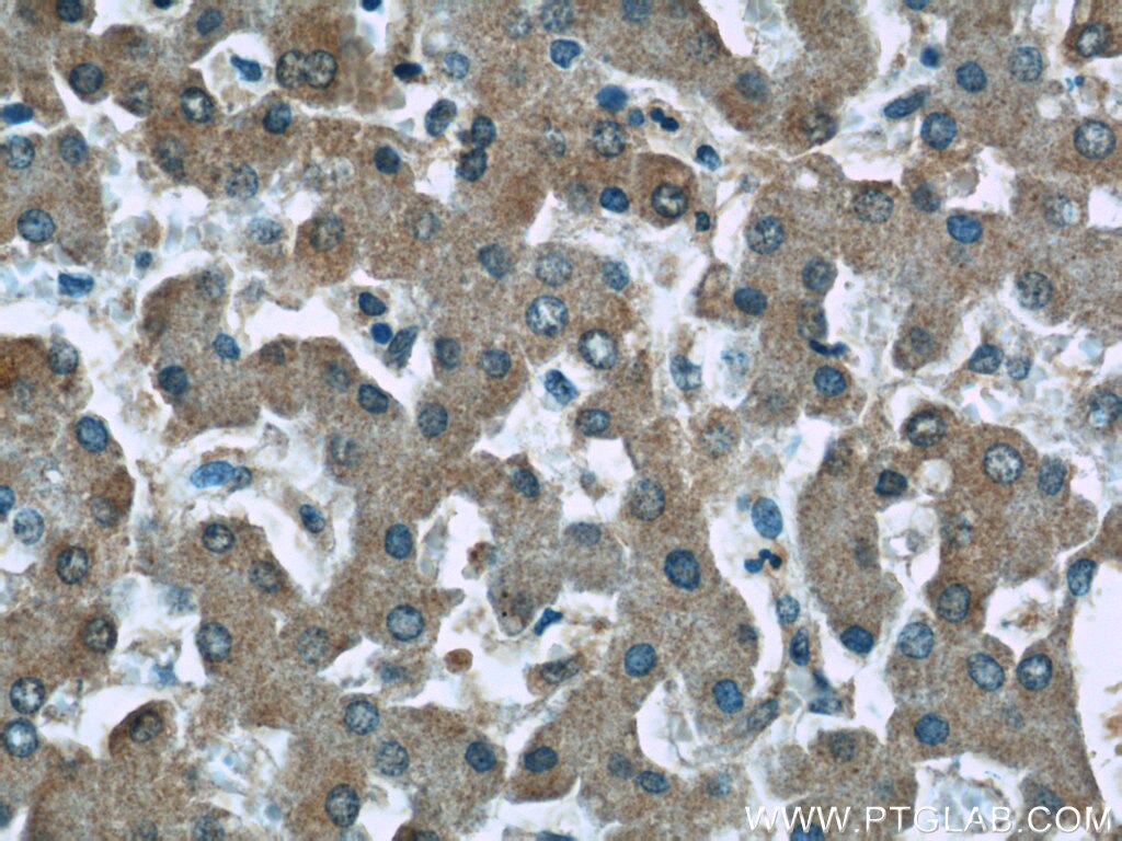 Immunohistochemistry (IHC) staining of human liver tissue using Fibrinogen Gamma Chain Monoclonal antibody (66158-1-Ig)