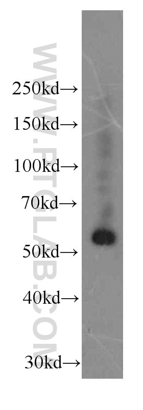 Western Blot (WB) analysis of L02 cells using Fibrinogen Gamma Chain Monoclonal antibody (66158-1-Ig)