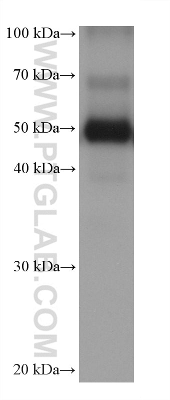 Western Blot (WB) analysis of human peripheral blood leukocyte using Fibrinogen Gamma Chain Monoclonal antibody (66158-1-Ig)