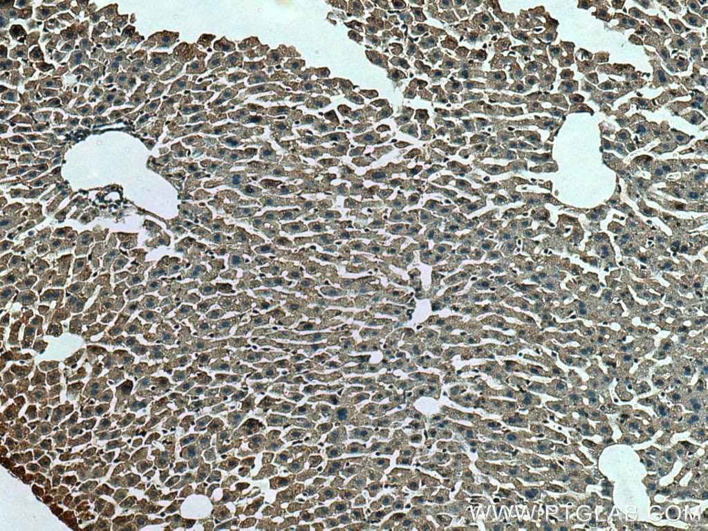 Immunohistochemistry (IHC) staining of mouse liver tissue using FGL1 Polyclonal antibody (16000-1-AP)