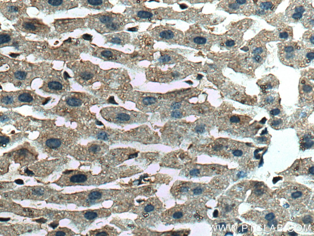 Immunohistochemistry (IHC) staining of mouse liver tissue using FGL1 Polyclonal antibody (16000-1-AP)