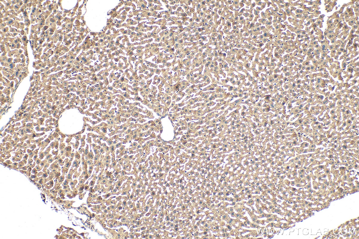 IHC staining of mouse liver using 16000-1-AP