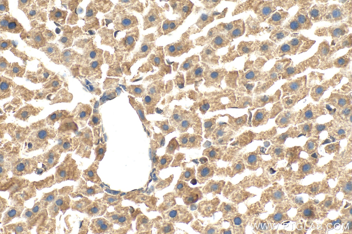 Immunohistochemistry (IHC) staining of mouse liver tissue using FGL1 Polyclonal antibody (16000-1-AP)