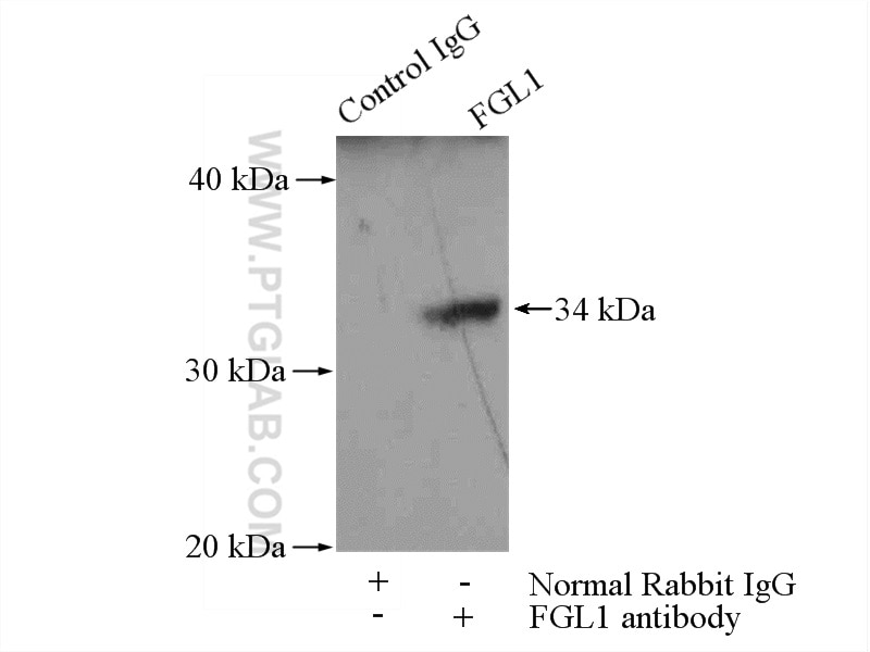 Immunoprecipitation (IP) experiment of HeLa cells using FGL1 Polyclonal antibody (16000-1-AP)