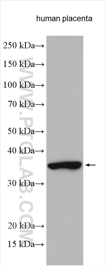 Western Blot (WB) analysis of various lysates using FGL1 Polyclonal antibody (16000-1-AP)