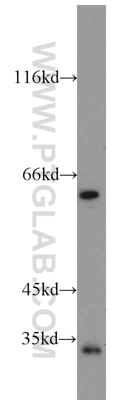 Western Blot (WB) analysis of HepG2 cells using FGL1 Polyclonal antibody (16000-1-AP)