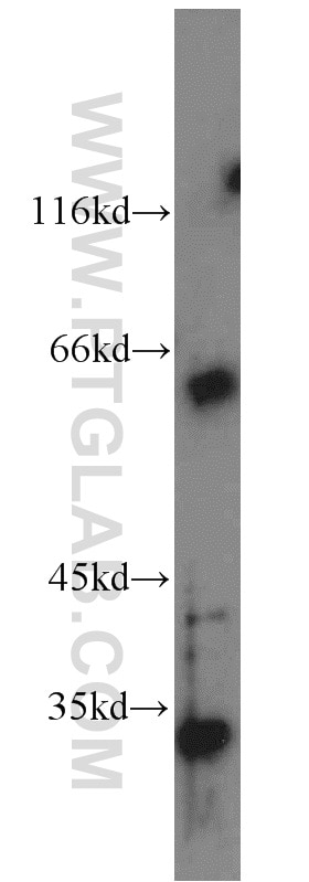 Western Blot (WB) analysis of mouse thymus tissue using FGL1 Polyclonal antibody (16000-1-AP)