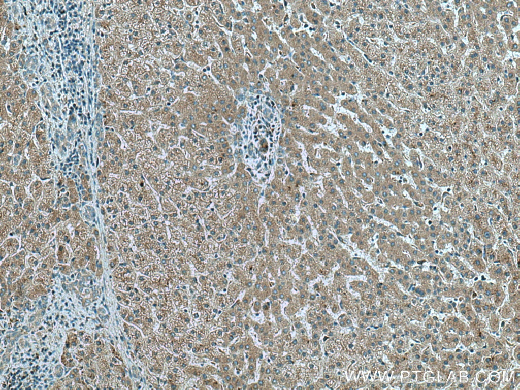 Immunohistochemistry (IHC) staining of human liver tissue using FGL1 Monoclonal antibody (67391-1-Ig)