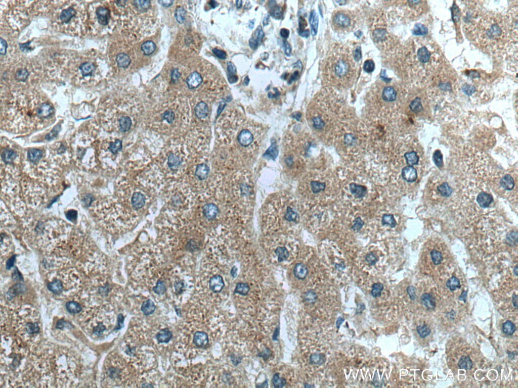 Immunohistochemistry (IHC) staining of human liver tissue using FGL1 Monoclonal antibody (67391-1-Ig)