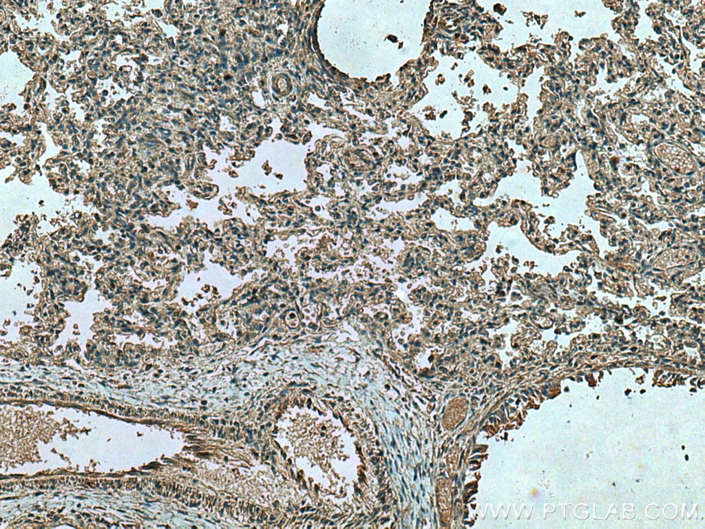 Immunohistochemistry (IHC) staining of human lung tissue using FGL1 Monoclonal antibody (67391-1-Ig)