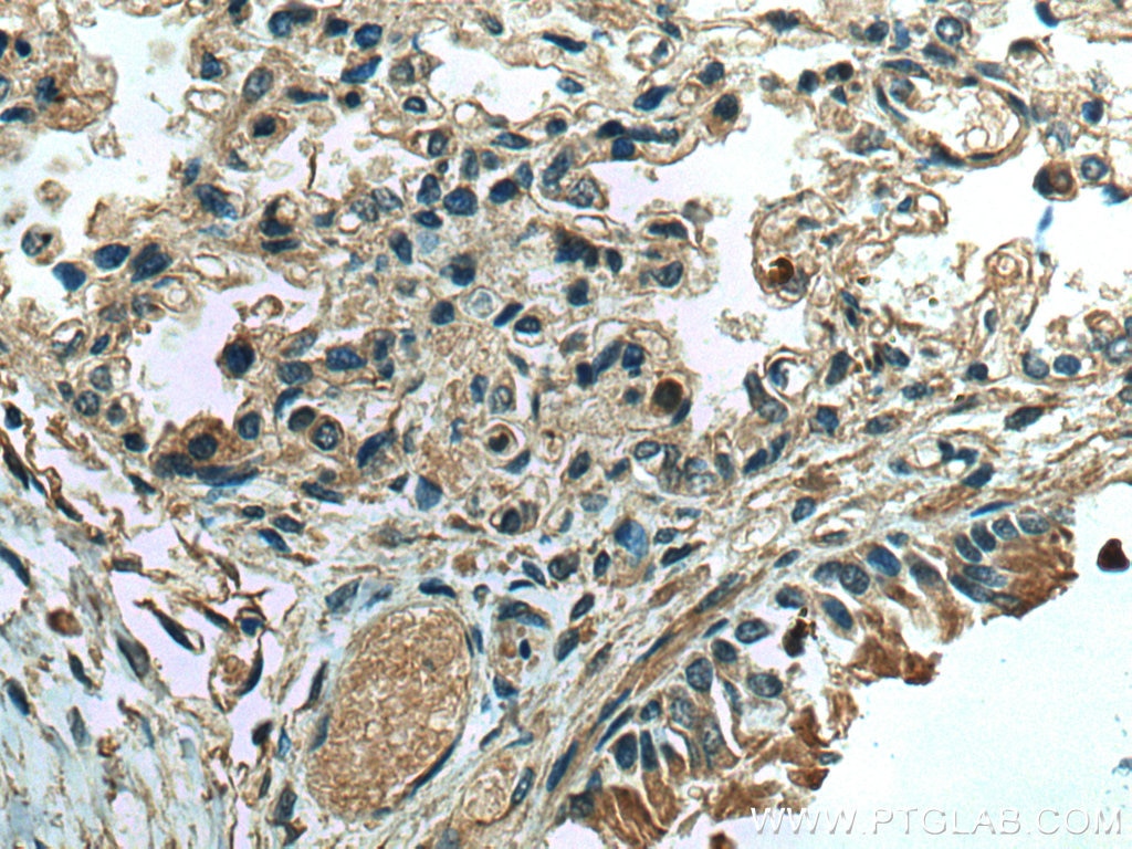 Immunohistochemistry (IHC) staining of human lung tissue using FGL1 Monoclonal antibody (67391-1-Ig)