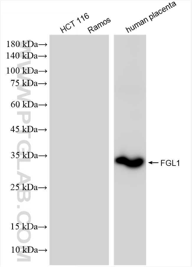 Various lysates were subjected to SDS PAGE followed by western blot with 86426-2-RR (FGL1 antibody) at dilution of 1:10000 incubated at room temperature for 1.5 hours. Western Blot (WB) analysis of various lysates using FGL1 Recombinant antibody (86426-2-RR)