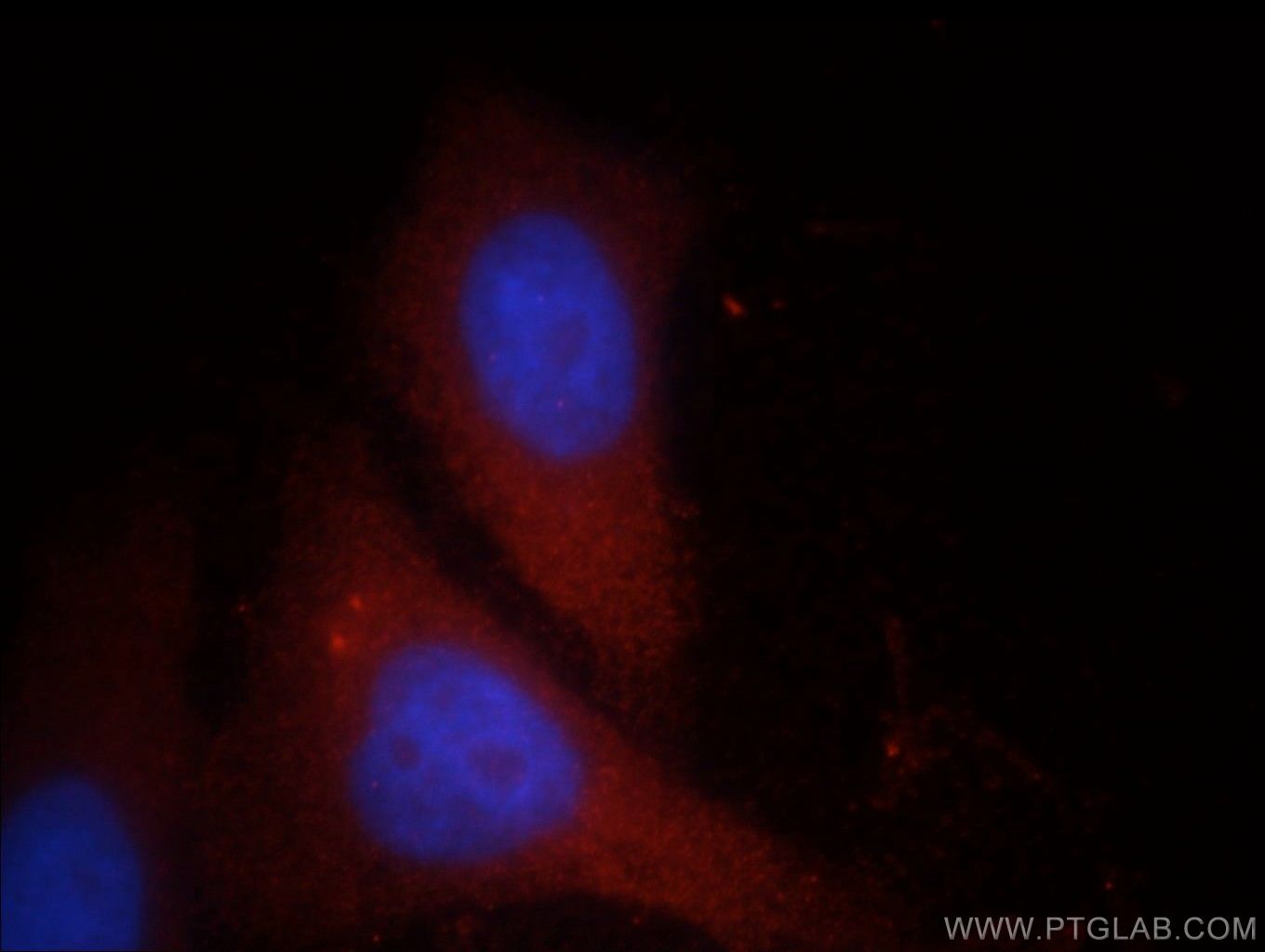 Immunofluorescence (IF) / fluorescent staining of HepG2 cells using FGL2 Polyclonal antibody (11827-1-AP)