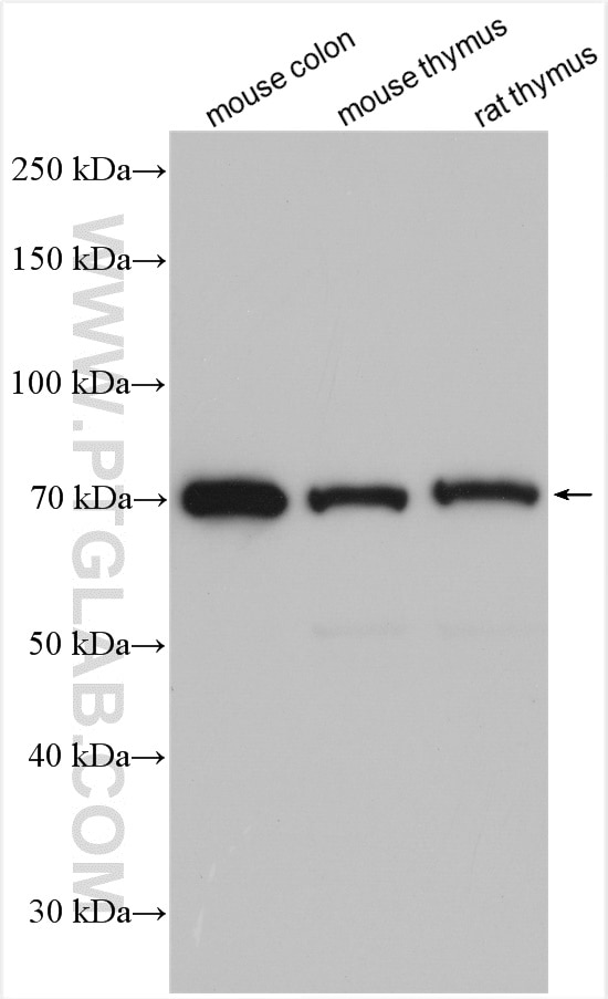 Western Blot (WB) analysis of various lysates using FGL2 Polyclonal antibody (11827-1-AP)
