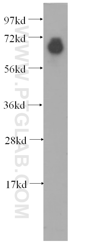 Western Blot (WB) analysis of human ileum tissue using FGL2 Polyclonal antibody (11827-1-AP)