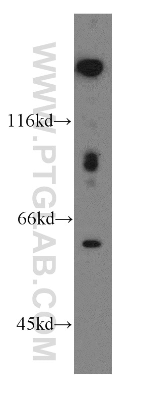 Western Blot (WB) analysis of mouse thymus tissue using FGL2 Polyclonal antibody (11827-1-AP)