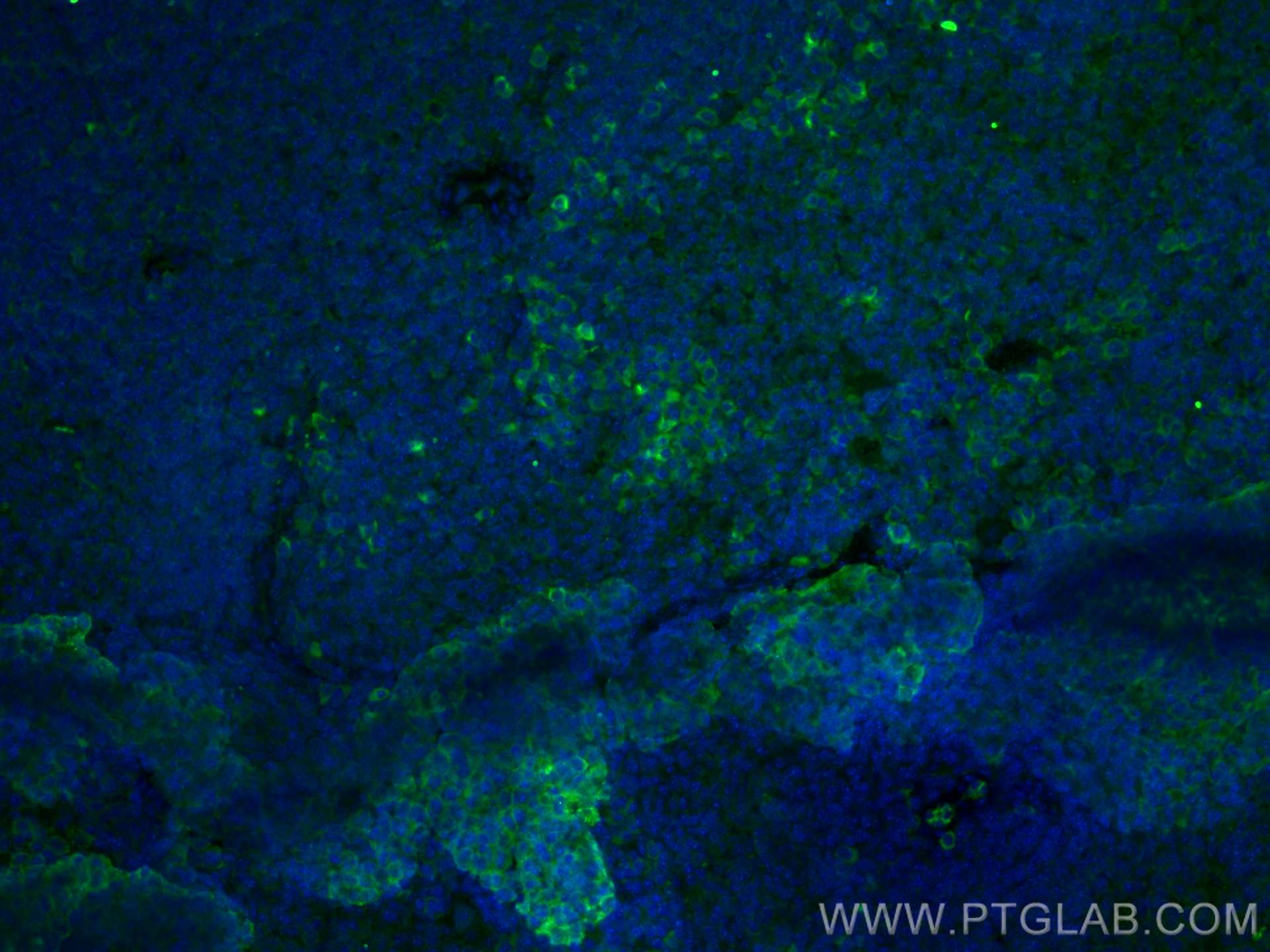 Immunofluorescence (IF) / fluorescent staining of mouse spleen tissue using FGL2 Monoclonal antibody (67152-1-Ig)