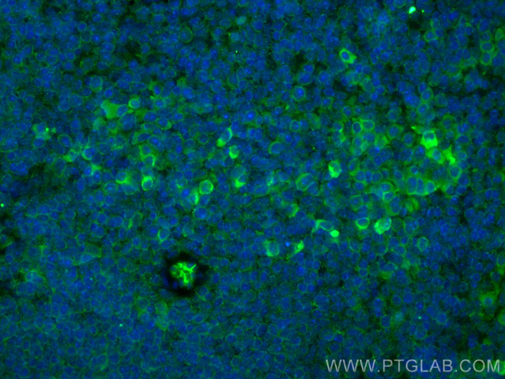 Immunofluorescence (IF) / fluorescent staining of mouse spleen tissue using FGL2 Monoclonal antibody (67152-1-Ig)