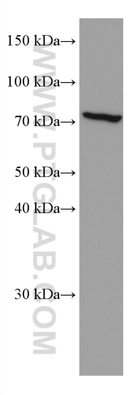 Western Blot (WB) analysis of THP-1 cells using FGL2 Monoclonal antibody (67152-1-Ig)