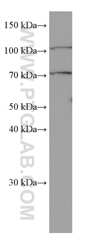 Western Blot (WB) analysis of Jurkat cells using FGL2 Monoclonal antibody (67152-1-Ig)