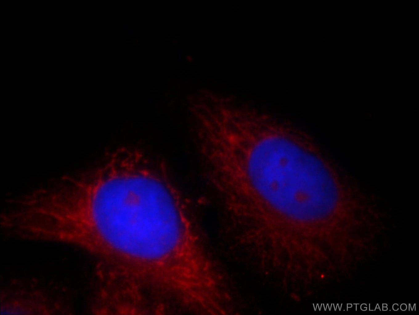Immunofluorescence (IF) / fluorescent staining of HepG2 cells using FH Polyclonal antibody (10966-1-AP)