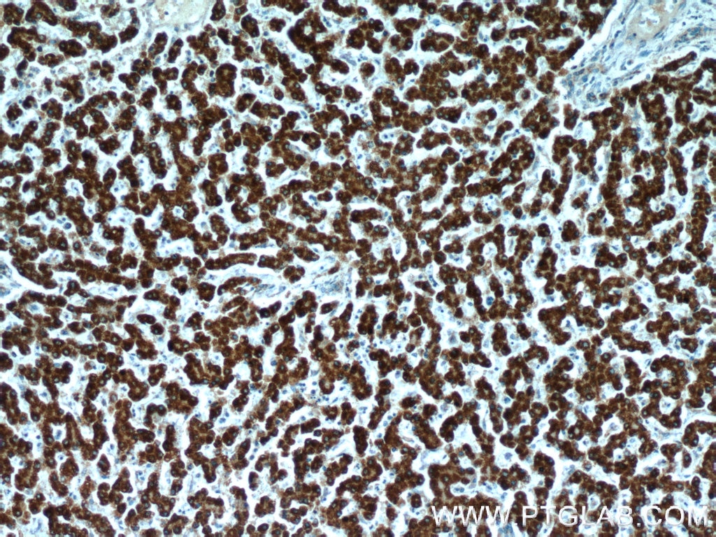 Immunohistochemistry (IHC) staining of human liver tissue using FH Polyclonal antibody (10966-1-AP)