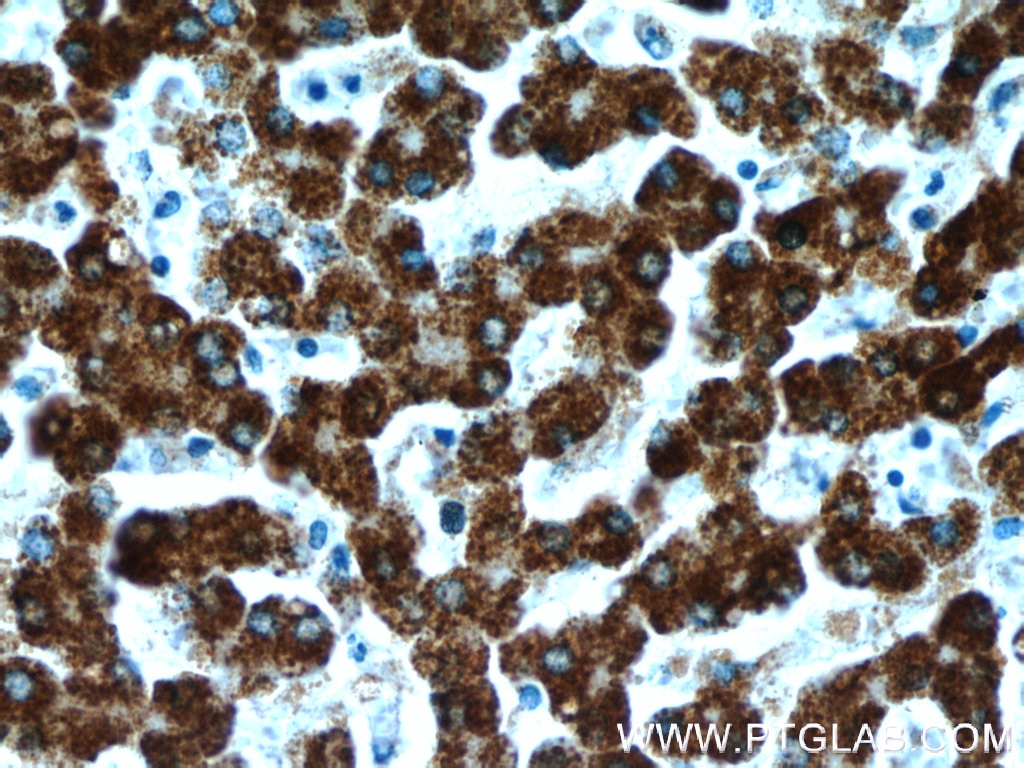 Immunohistochemistry (IHC) staining of human liver tissue using FH Polyclonal antibody (10966-1-AP)