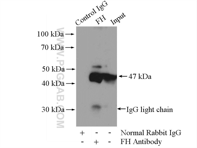 Immunoprecipitation (IP) experiment of HepG2 cells using FH Polyclonal antibody (10966-1-AP)