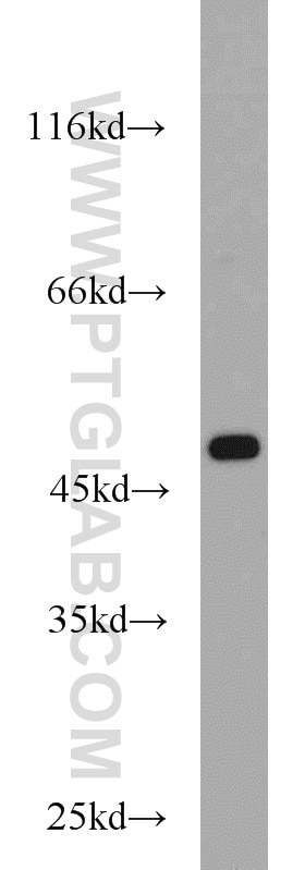 Western Blot (WB) analysis of HeLa cells using FH Polyclonal antibody (10966-1-AP)