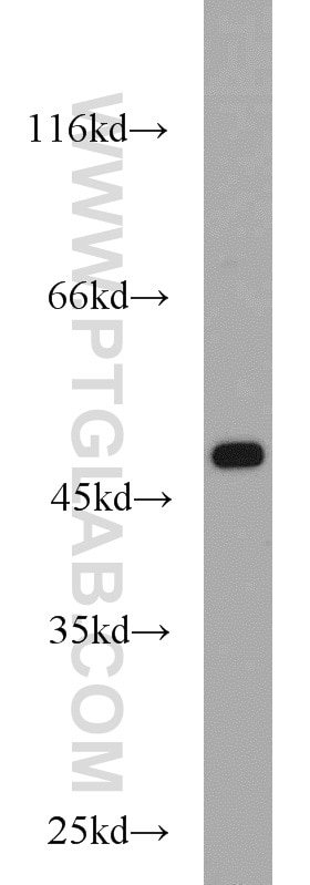 WB analysis of HeLa using 10966-1-AP