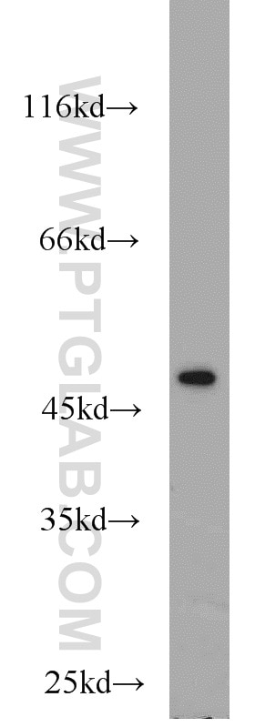 Western Blot (WB) analysis of A431 cells using FH Polyclonal antibody (10966-1-AP)