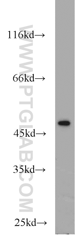 WB analysis of A431 using 10966-1-AP