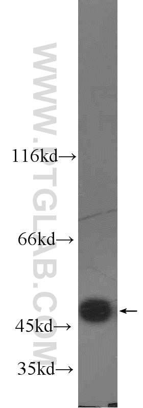 Western Blot (WB) analysis of human liver tissue using FH Polyclonal antibody (10966-1-AP)