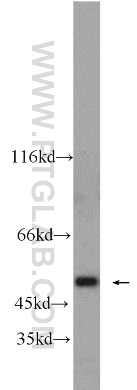 Western Blot (WB) analysis of HEK-293 cells using FH Polyclonal antibody (10966-1-AP)