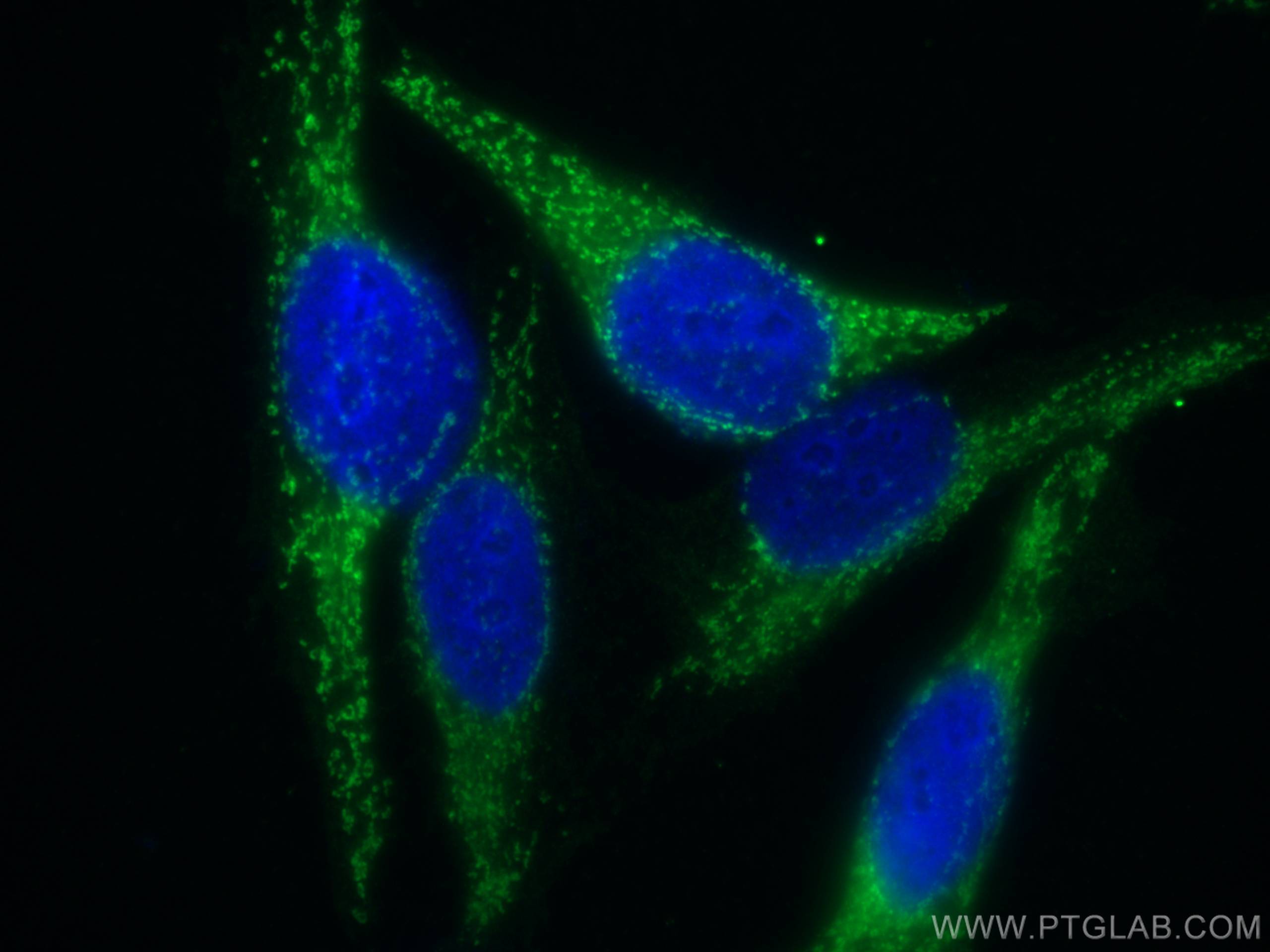 Immunofluorescence (IF) / fluorescent staining of HeLa cells using FH Polyclonal antibody (11375-1-AP)