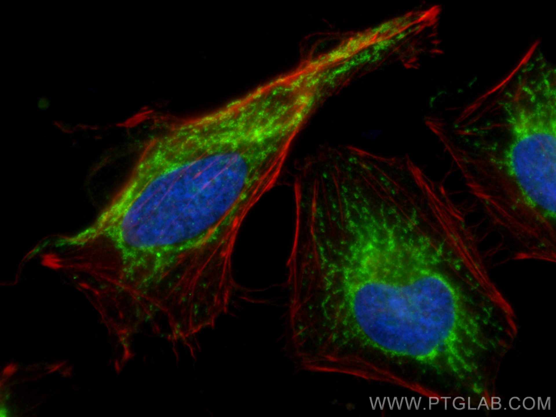 Immunofluorescence (IF) / fluorescent staining of HeLa cells using FH Polyclonal antibody (11375-1-AP)